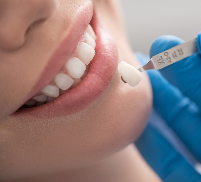 Treatment - Selsdon Dental