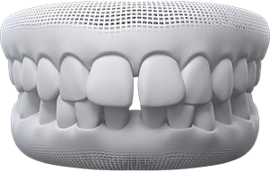 invisalign Teeth