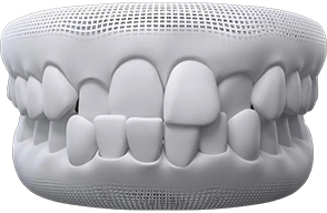 invisalign Teeth